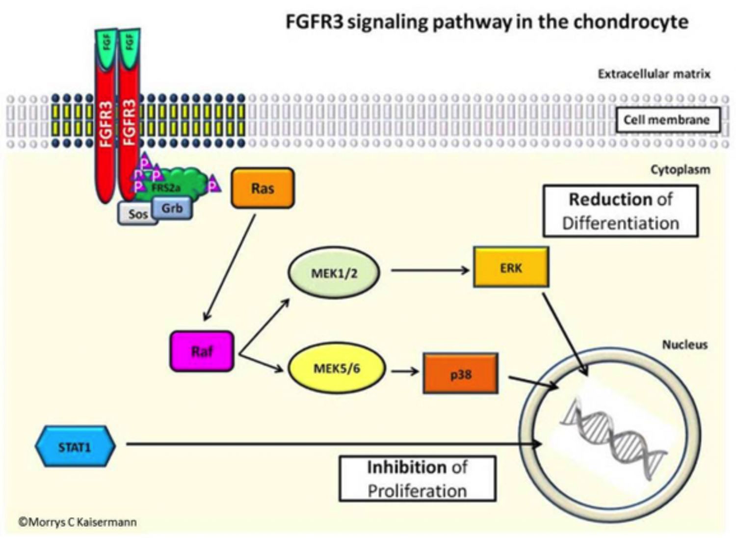 acondroplasia por mutación fgfr3